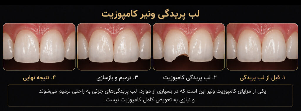 composite_chipping
