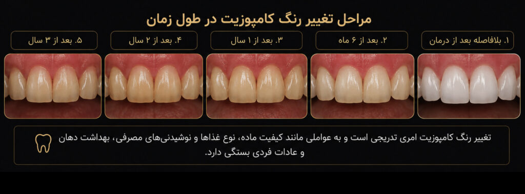 composite_discoloration